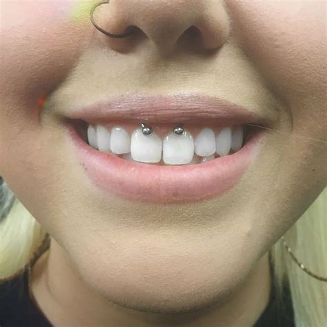 how long does a smiley piercing last|Smiley Piercings: Placement, Aftercare, Risks, and More